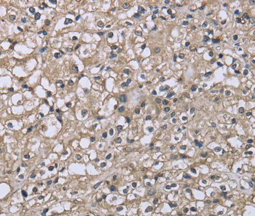 CD32 Polyclonal Antibody - image 1