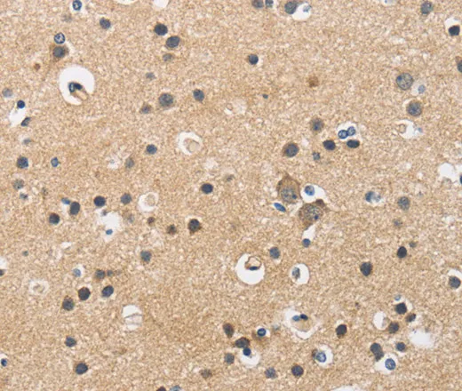 CKMT2 Polyclonal Antibody - image 1