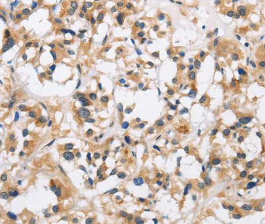CKMT2 Polyclonal Antibody - image 2