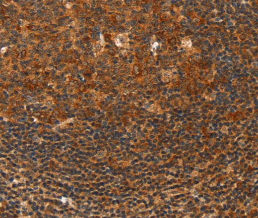 HDAC8 Polyclonal Antibody - image 1