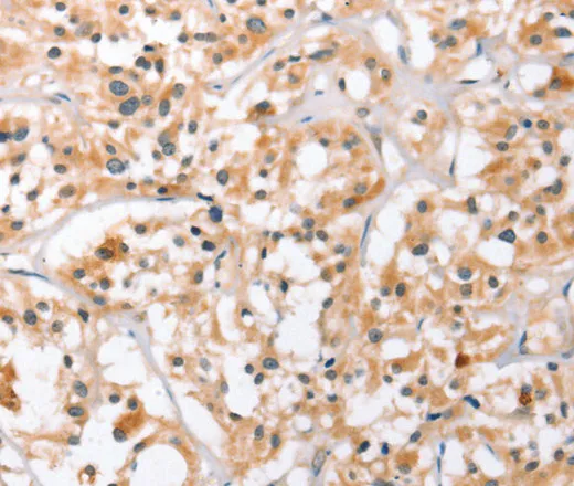 HDAC8 Polyclonal Antibody - image 2