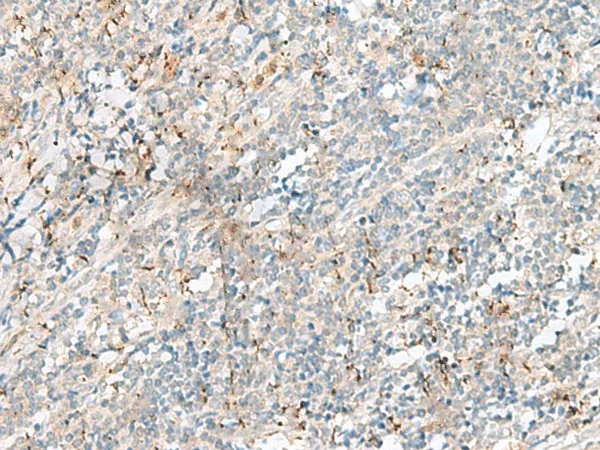 PLCL2 Polyclonal Antibody - image 1