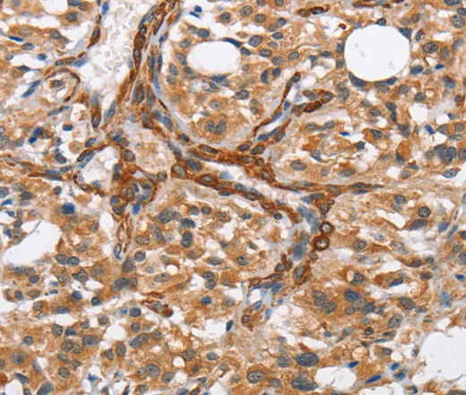 BUB1 Polyclonal Antibody - image 1