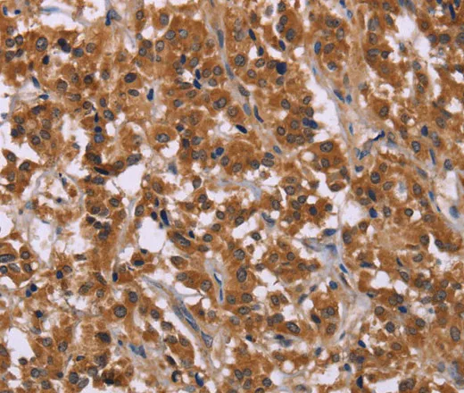 CMTM6 Polyclonal Antibody - image 1