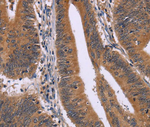CMTM6 Polyclonal Antibody - image 2
