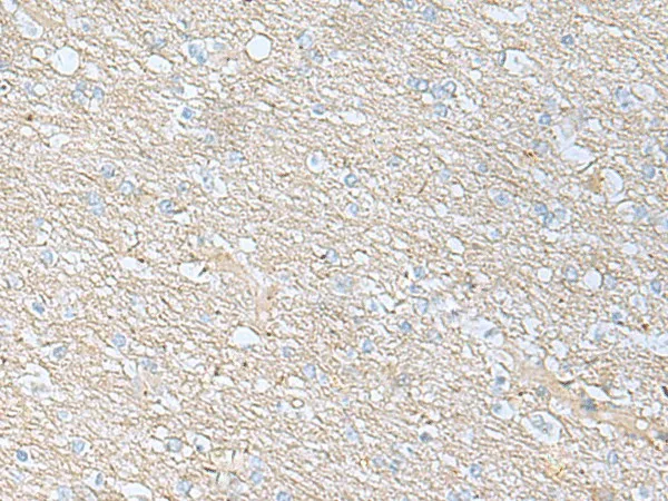 BDNF Polyclonal Antibody - image 1
