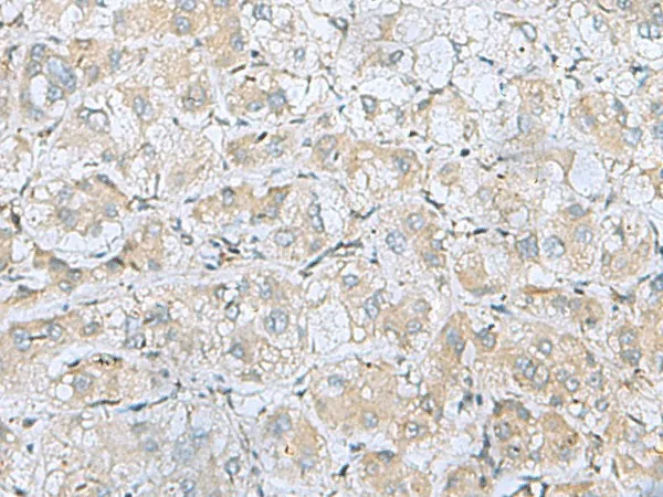 BDNF Polyclonal Antibody - image 2