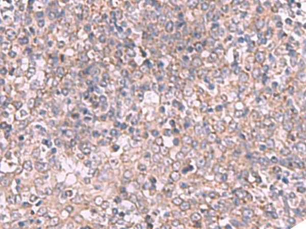 ECSIT Polyclonal Antibody - image 1