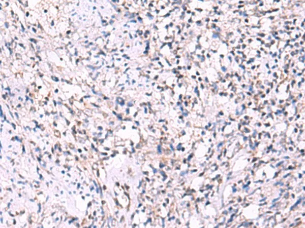 ECSIT Polyclonal Antibody - image 2
