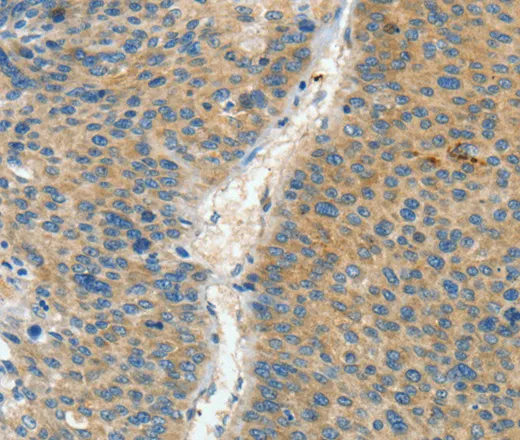 ASPA Polyclonal Antibody - image 1