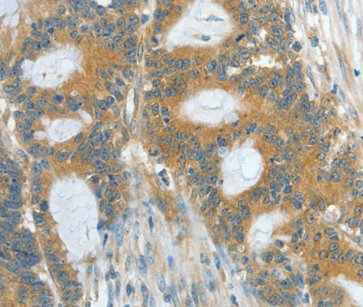 ASPA Polyclonal Antibody - image 2