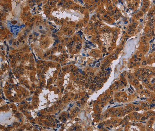 CYBB Polyclonal Antibody - image 1