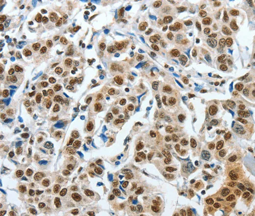 CREB1 Polyclonal Antibody - image 1