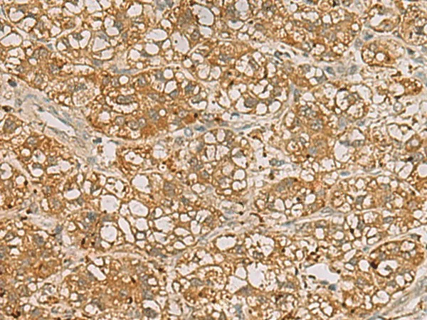 QDPR Polyclonal Antibody - image 1