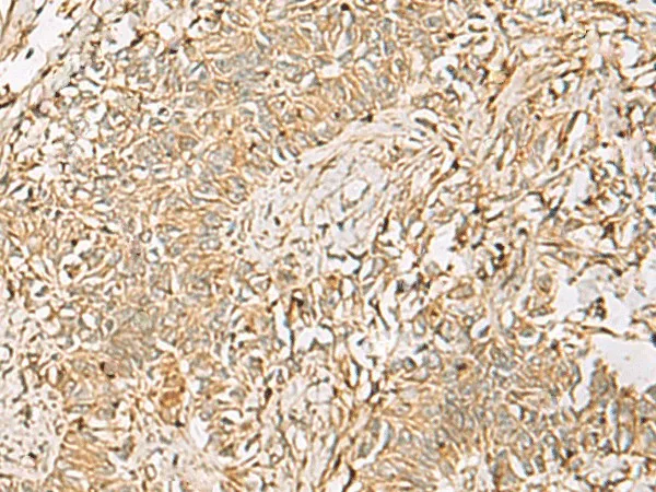 QDPR Polyclonal Antibody - image 2