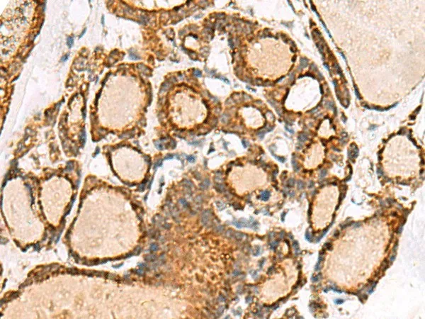 NPC2 Polyclonal Antibody - image 1