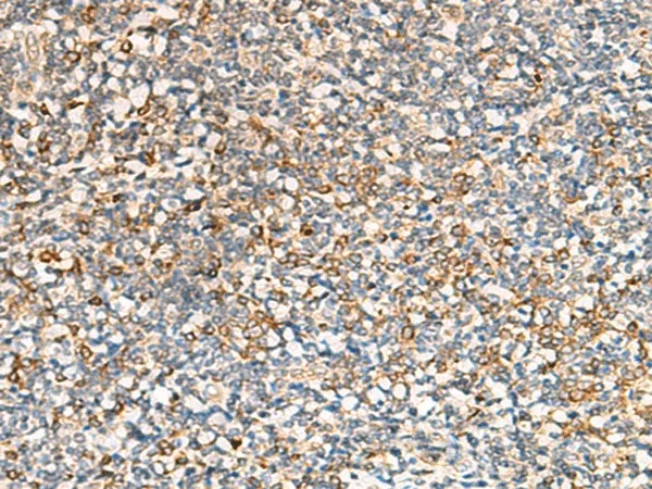SEC22B Polyclonal Antibody - image 1