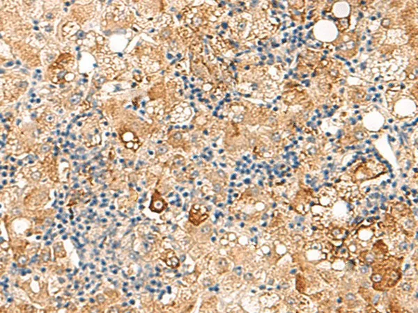 SEC22B Polyclonal Antibody - image 2