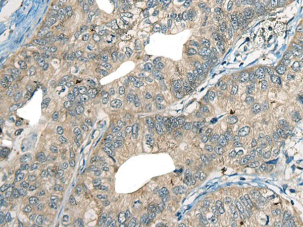 CDADC1 Polyclonal Antibody - image 1