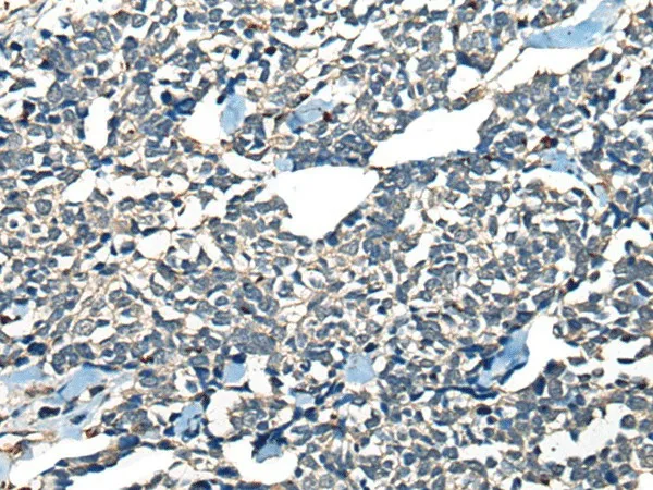 CDADC1 Polyclonal Antibody - image 2