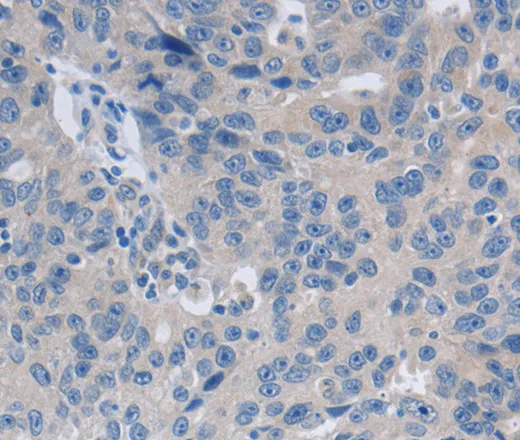 GRIN1 Polyclonal Antibody - image 1