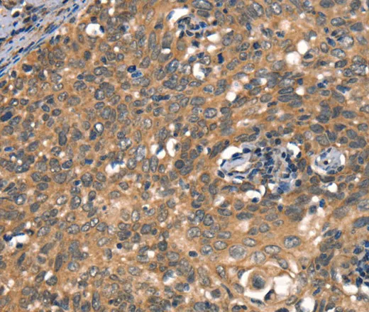 DAAM1 Polyclonal Antibody - image 1