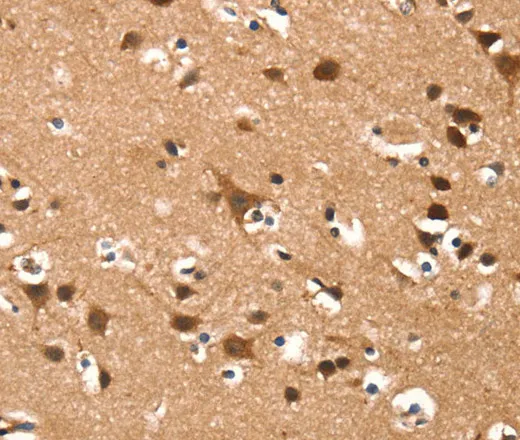 DAAM1 Polyclonal Antibody - image 2