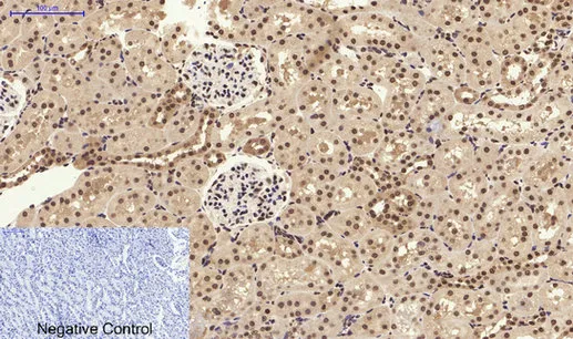 STAT3 Polyclonal Antibody - image 1