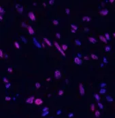 STAT3 Polyclonal Antibody - image 2