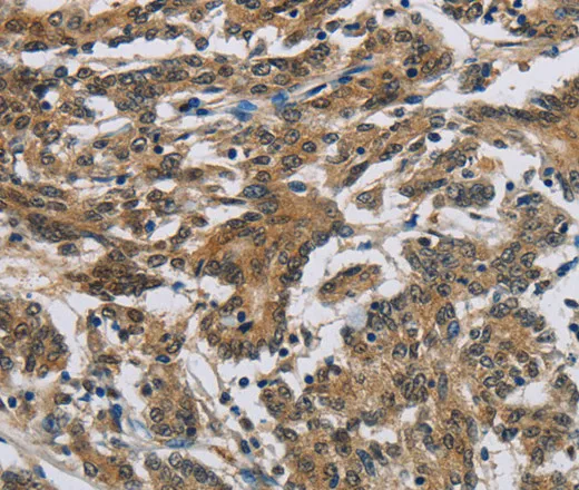 SYN1 Polyclonal Antibody - image 2