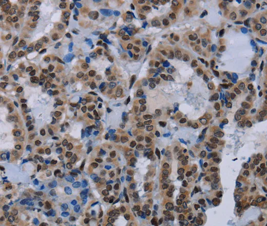 HMGB1 Polyclonal Antibody - image 1