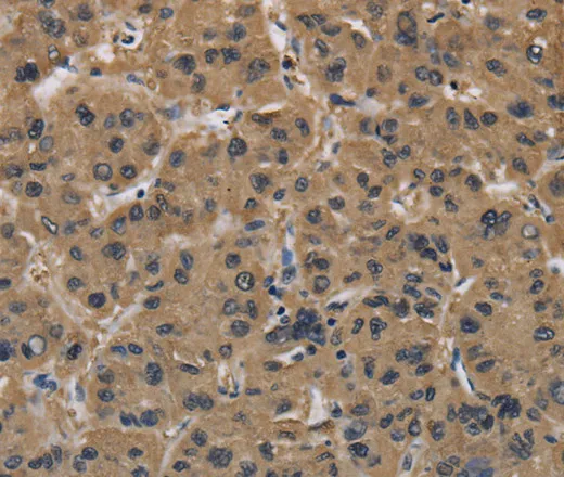 FABP2 Polyclonal Antibody - image 1