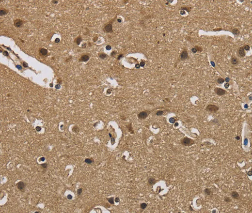 FABP2 Polyclonal Antibody - image 2