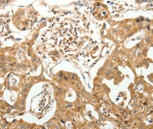 MAP1B Polyclonal Antibody - image 1