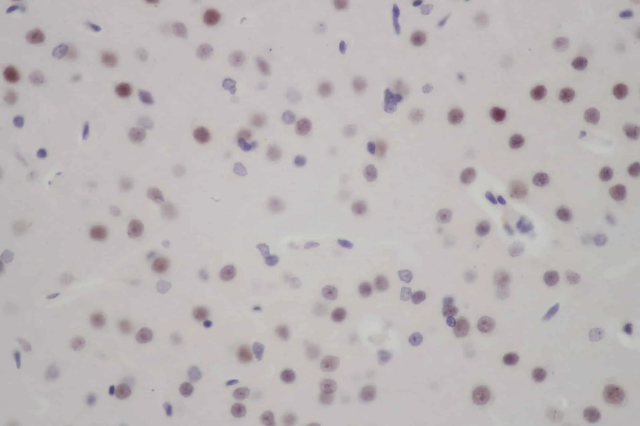 FOXO3 Polyclonal Antibody - image 1