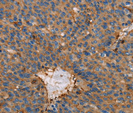 ACTA1 Polyclonal Antibody - image 1