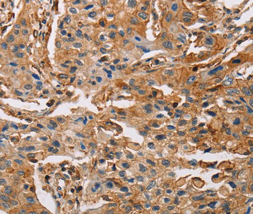 ACTA1 Polyclonal Antibody - image 2