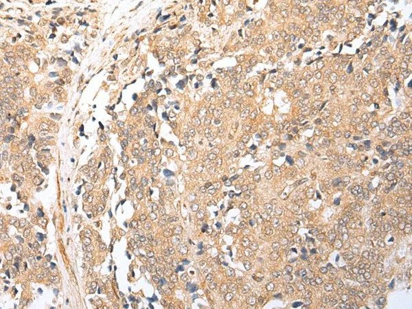 BAG2 Polyclonal Antibody - image 1