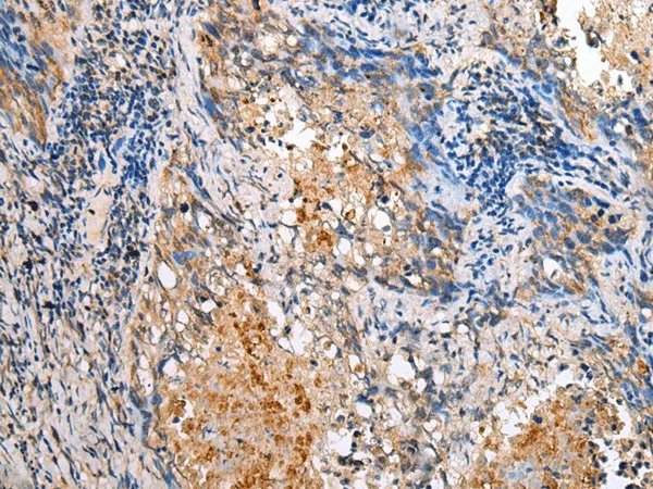 BAG2 Polyclonal Antibody - image 2