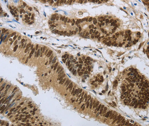 PRMT3 Polyclonal Antibody - image 1