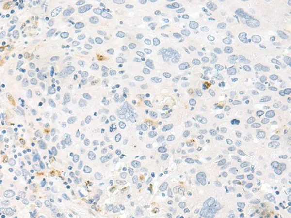 FABP4 Polyclonal Antibody - image 1
