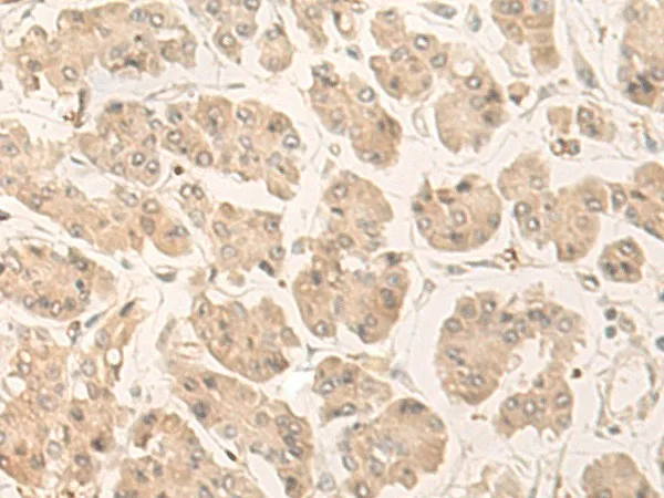 FABP4 Polyclonal Antibody - image 2