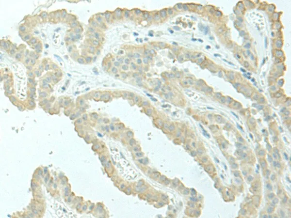 EVI2B Polyclonal Antibody - image 1