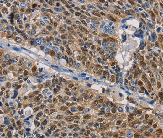 GSTA2 Polyclonal Antibody - image 1