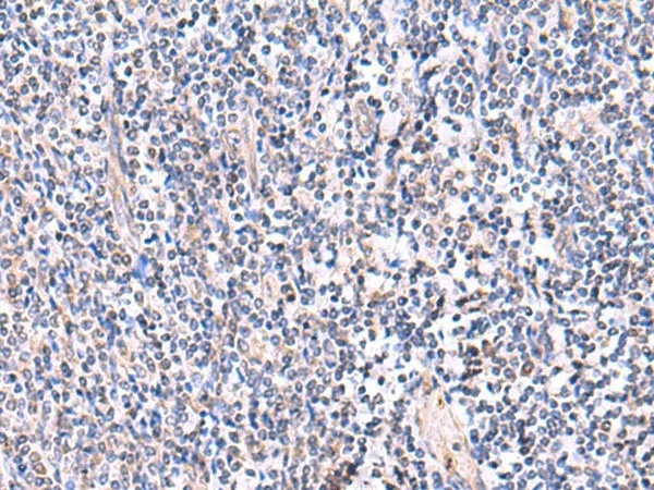 FDFT1 Polyclonal Antibody - image 1