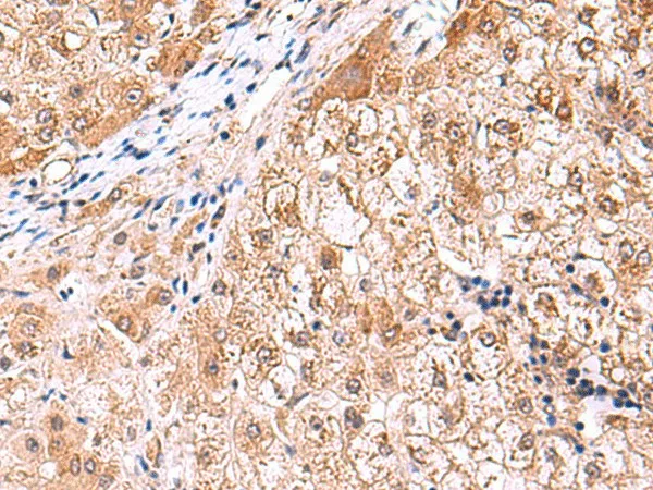 FDFT1 Polyclonal Antibody - image 2