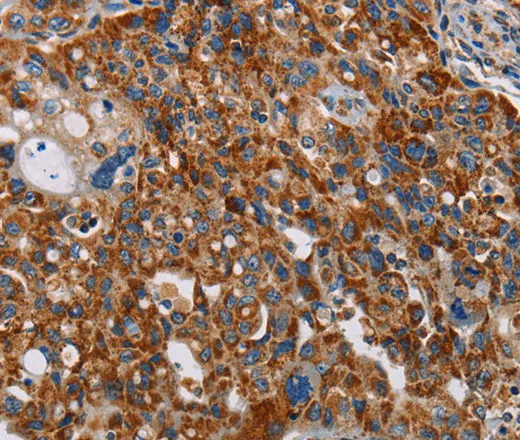 ALG2 Polyclonal Antibody - image 1