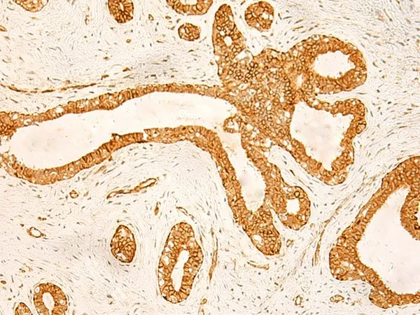 KRT76 Polyclonal Antibody - image 1