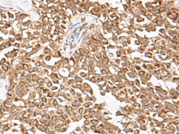 USP16 Polyclonal Antibody - image 1