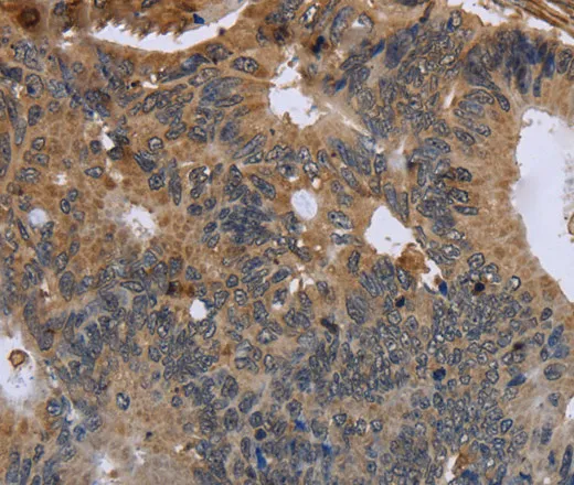 FLNA Polyclonal Antibody - image 1